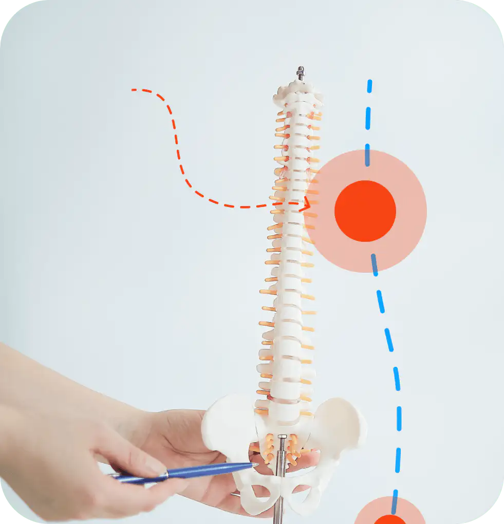 Spine drawing