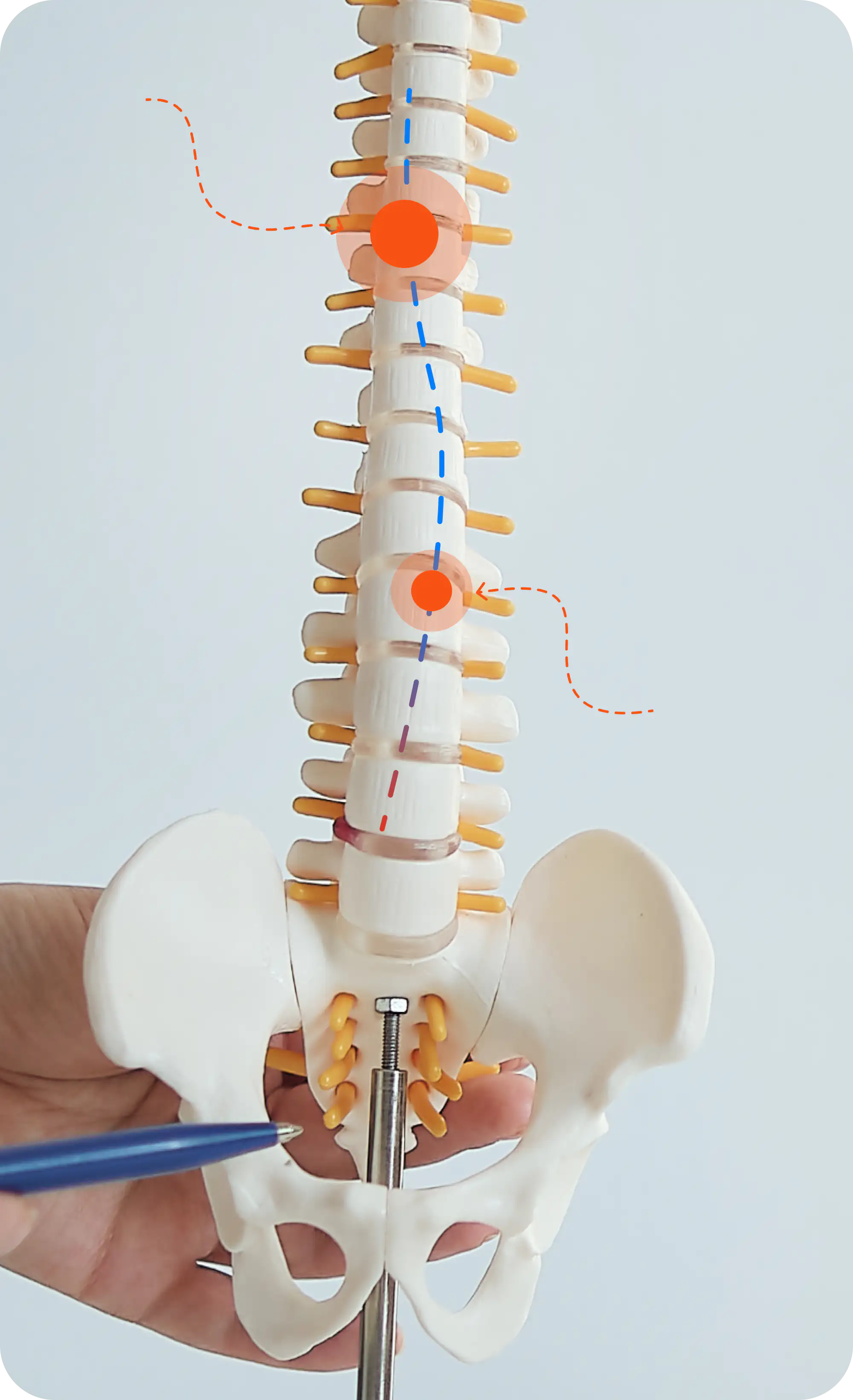 Spine pain